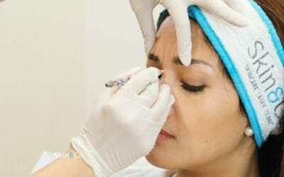 Botox Allergan Solusi untuk Kerutan dan Peremajaan Kulit