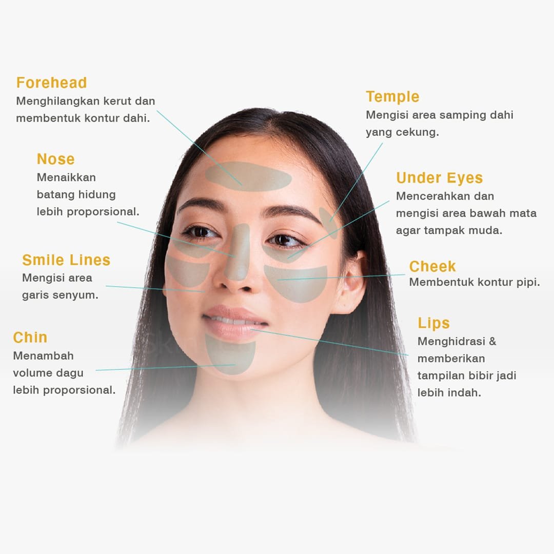 Titik Perawatan Filler Titik Perawatan Filler